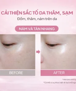 KNB Radiant Skin Care Cream, kem dưỡng ẩm SKNB, kem dưỡng da mặt, kem dưỡng cấp ẩm, kem dưỡng sáng da, kem dưỡng chống lão hóa