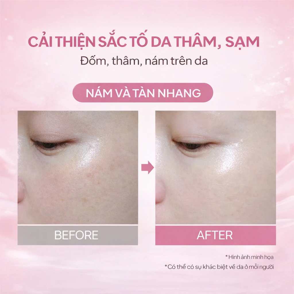 KNB Radiant Skin Care Cream, kem dưỡng ẩm SKNB, kem dưỡng da mặt, kem dưỡng cấp ẩm, kem dưỡng sáng da, kem dưỡng chống lão hóa
