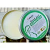 Kem dưỡng ngừa rạn da