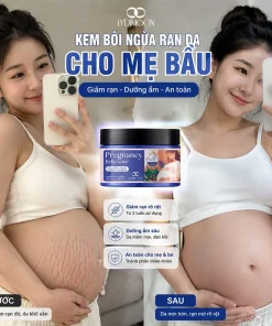 kem rạn da cho bà bầu, kem chống rạn da bà bầu, kem trị rạn da sau sinh, kem dưỡng da bà bầu, kem dưỡng ẩm cho mẹ bầu, kem ngừa rạn bụng bầu