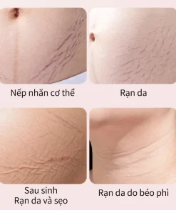 kem rạn da cho bà bầu, kem chống rạn da bà bầu, kem trị rạn da sau sinh, kem dưỡng da bà bầu, kem dưỡng ẩm cho mẹ bầu, kem ngừa rạn bụng bầu
