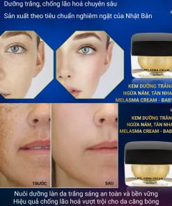 Kem dưỡng trắng Baby Milk, Kem trị nám Baby Milk, Kem dưỡng Melasma Cream, Kem dưỡng trắng da Baby Milk 30g, Kem dưỡng mờ nám Baby Milk, dưỡng trắng da, làm sáng da, hỗ trợ mờ nám, giảm đốm nâu