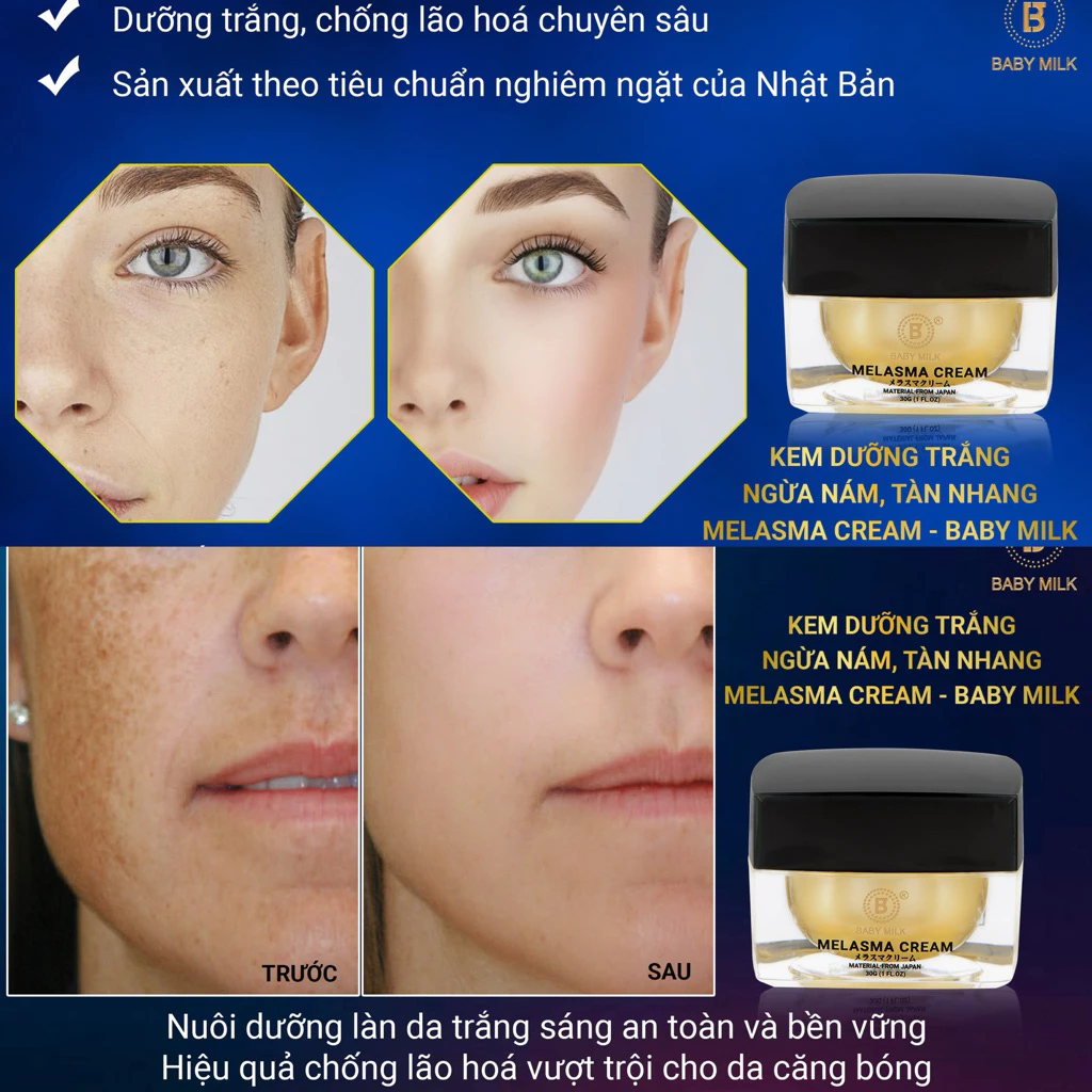 Kem dưỡng trắng Baby Milk, Kem trị nám Baby Milk, Kem dưỡng Melasma Cream, Kem dưỡng trắng da Baby Milk 30g, Kem dưỡng mờ nám Baby Milk, dưỡng trắng da, làm sáng da, hỗ trợ mờ nám, giảm đốm nâu