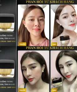 Kem dưỡng trắng Baby Milk, Kem trị nám Baby Milk, Kem dưỡng Melasma Cream, Kem dưỡng trắng da Baby Milk 30g, Kem dưỡng mờ nám Baby Milk, dưỡng trắng da, làm sáng da, hỗ trợ mờ nám, giảm đốm nâu