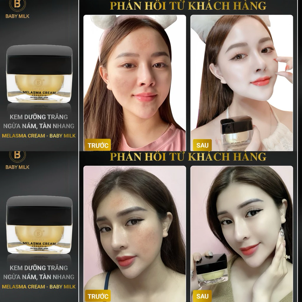 Kem dưỡng trắng Baby Milk, Kem trị nám Baby Milk, Kem dưỡng Melasma Cream, Kem dưỡng trắng da Baby Milk 30g, Kem dưỡng mờ nám Baby Milk, dưỡng trắng da, làm sáng da, hỗ trợ mờ nám, giảm đốm nâu